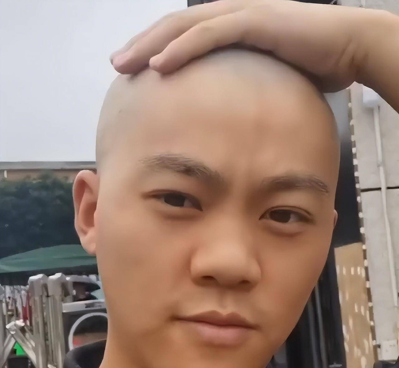 网红光头强版的小苹果:重庆男子挑战1年不理发，光头到长发颜值飘忽不定，撞脸多位男星