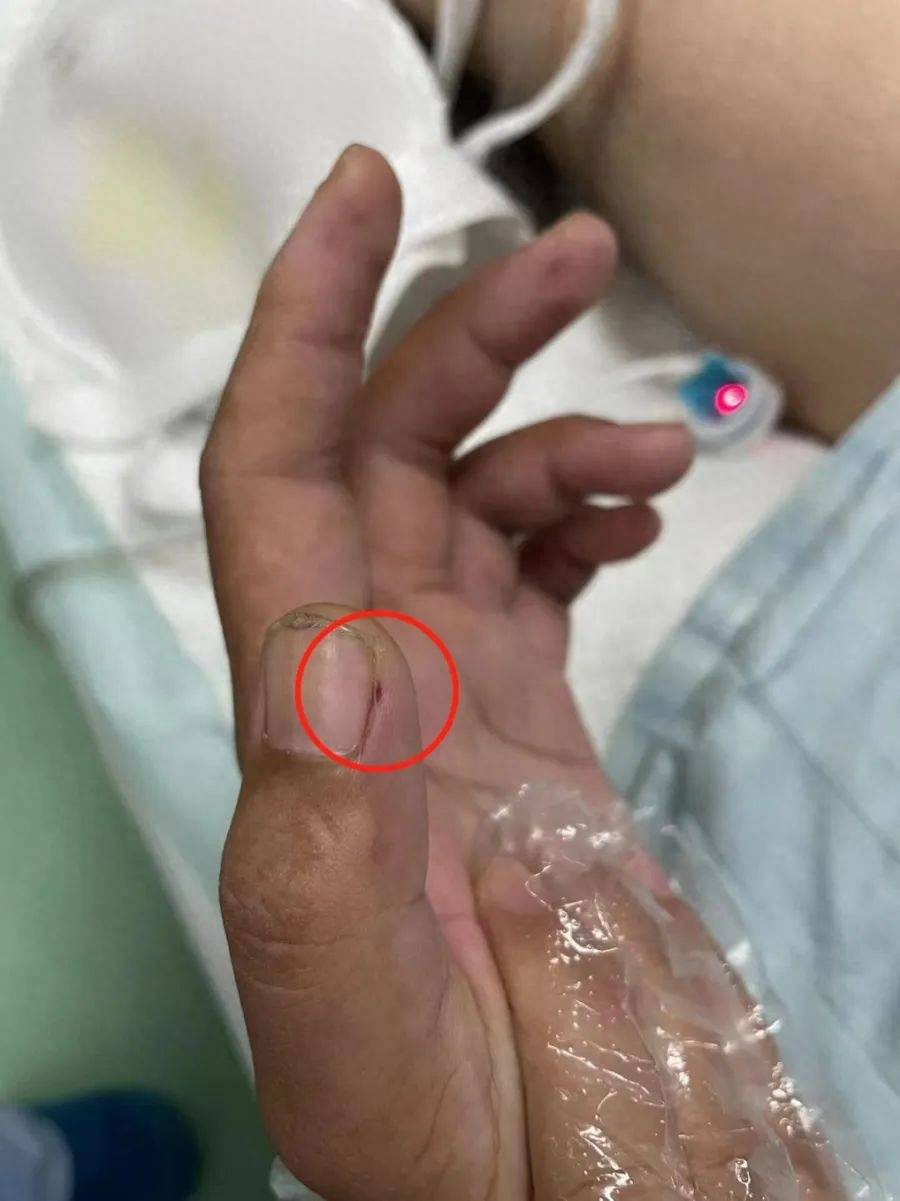 �:广东一男子切生猪肉险丧命，只因一个小细节……