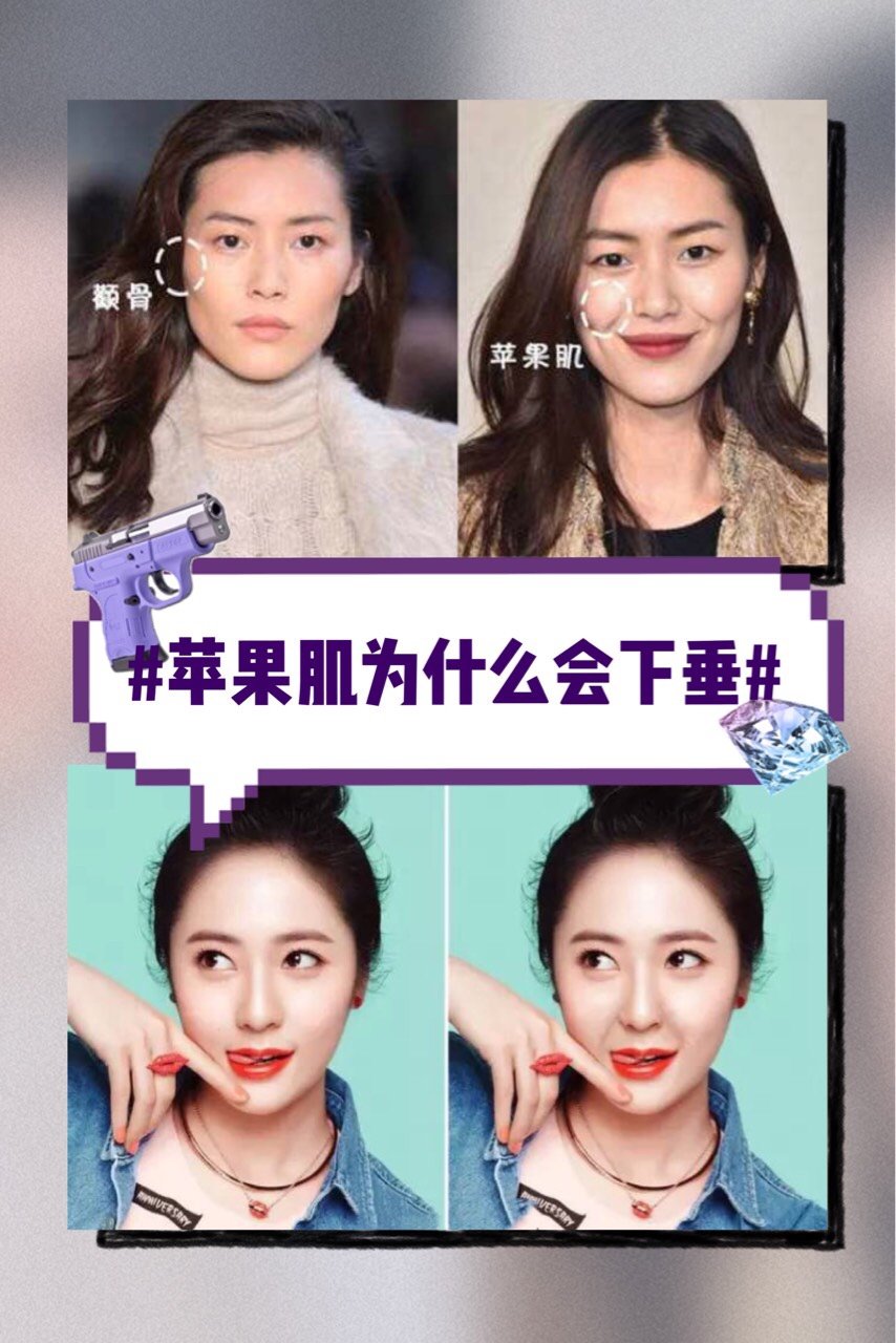 苹果肌新闻脸部苹果肌是哪个部位-第2张图片-太平洋在线下载